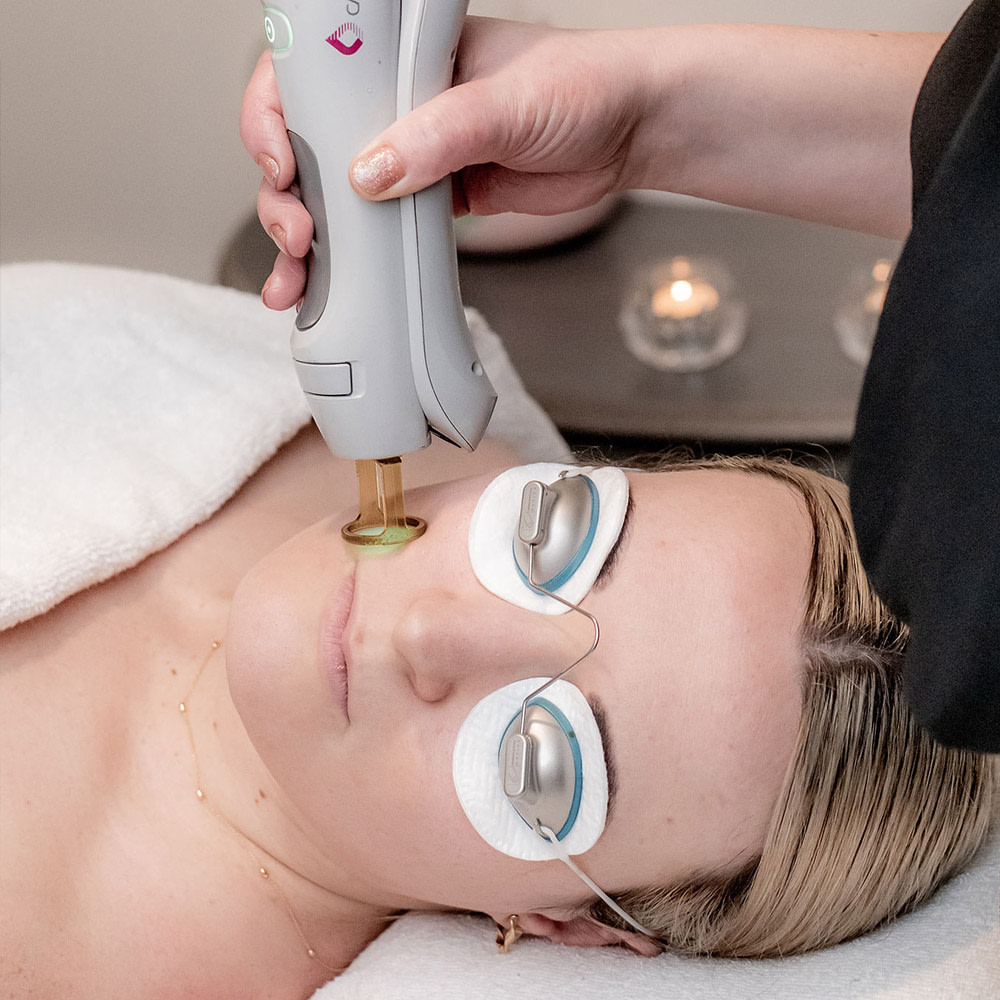 Gore Laser Treatments